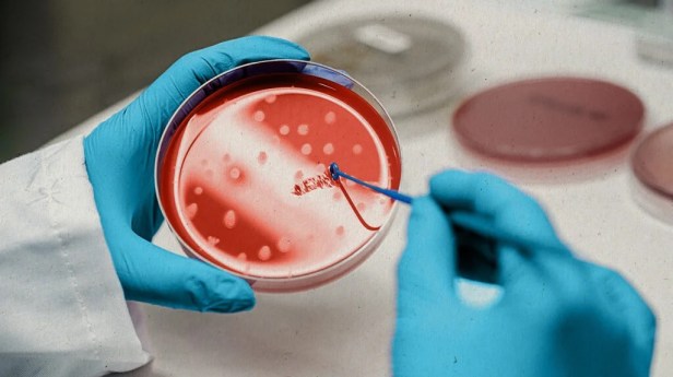 What Is Stem Cell Therapy for Nerve Injury