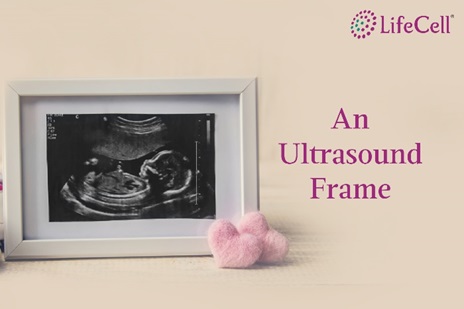 An Ultrasound Frame